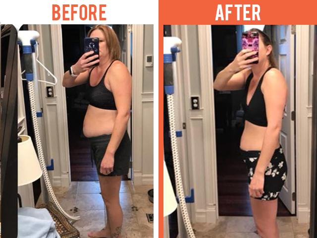 Evolve Wellness | Bariatric Surgery | Reno, NV