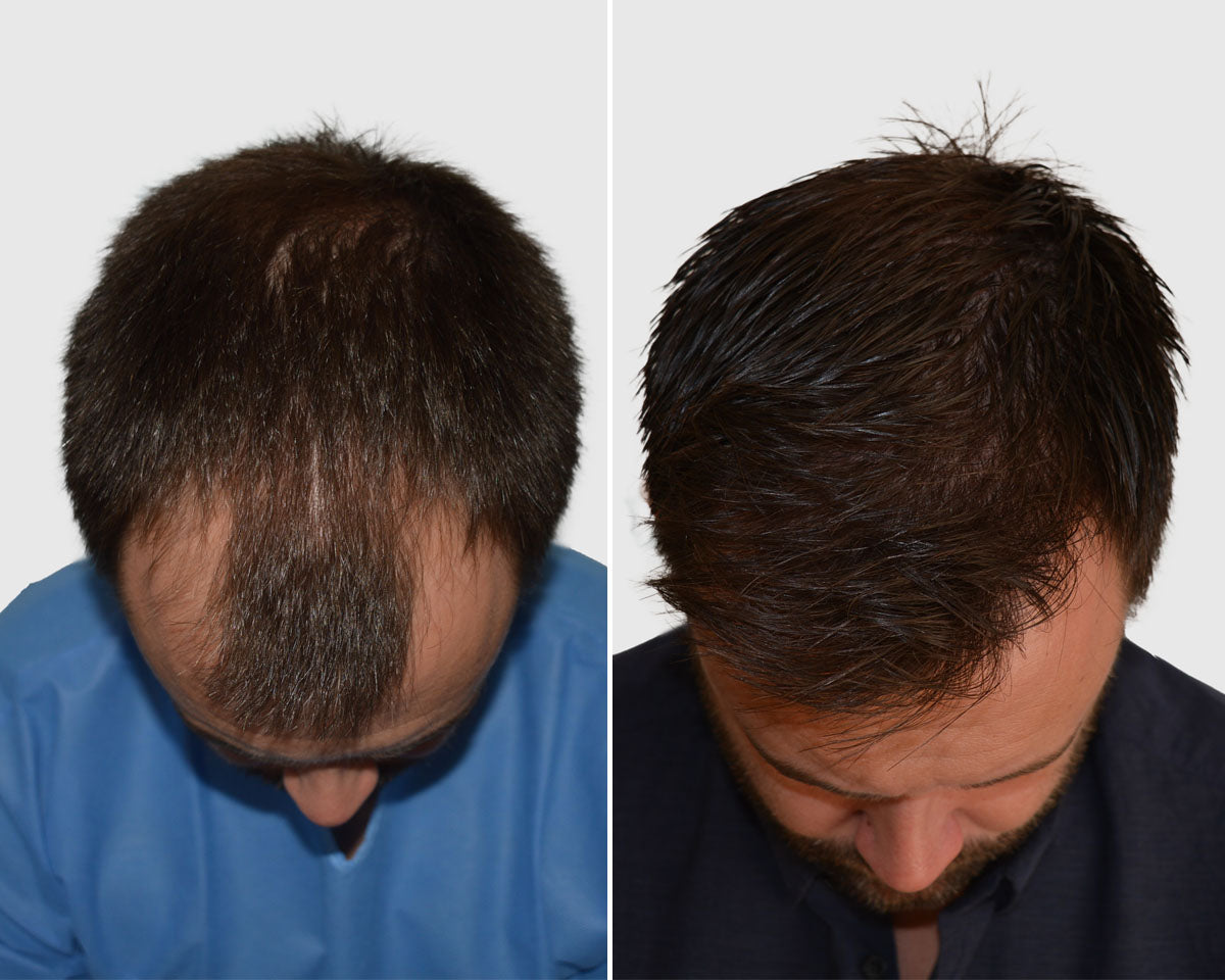 Seneca Medical Group - Hair Transplant clinic in Edinburgh, United Kingdom