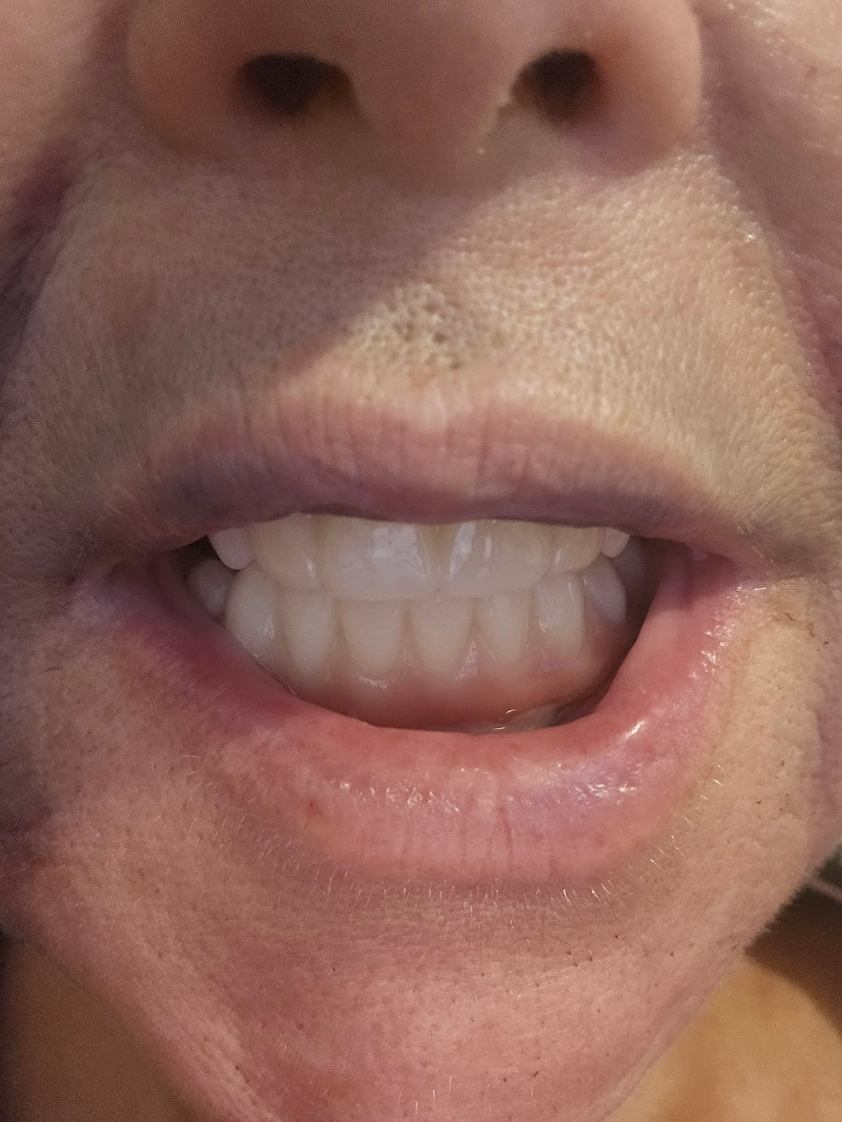 New Life Teeth - Dental Implants Clinic — photo 2
