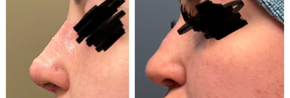 Dr. Mark A. Armeni, MD | Aesthetic Surgery | Morgantown, WV