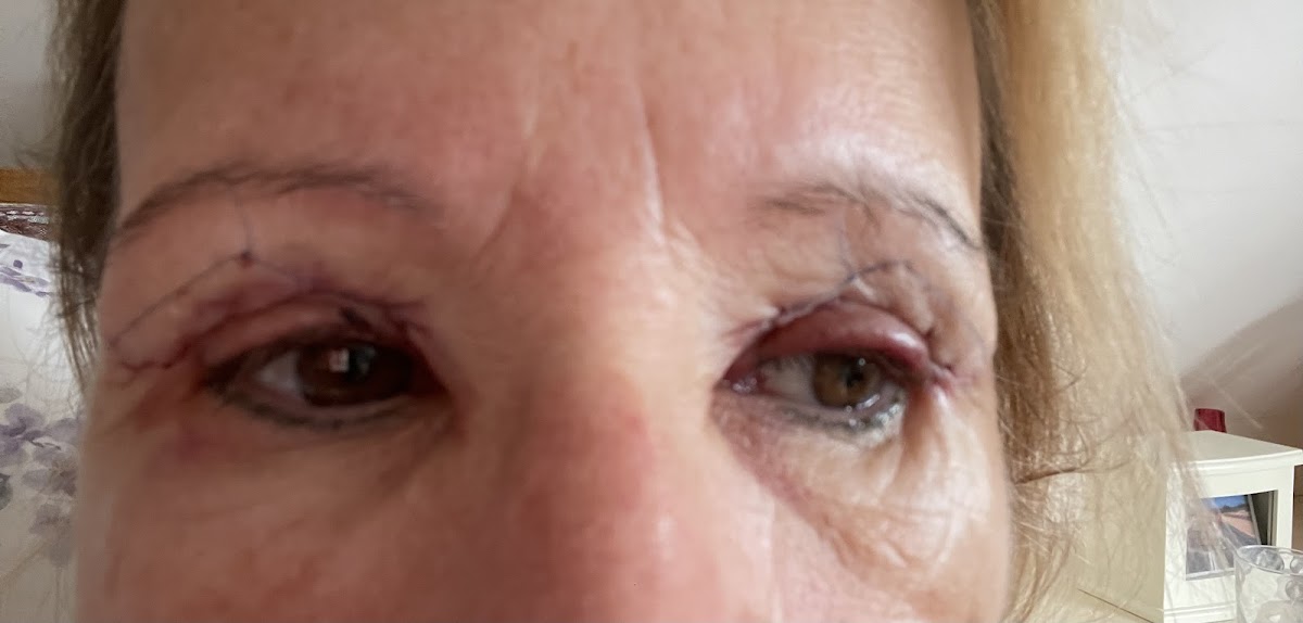 The Precision Surgery Clinic — Dr.Visor photo 5