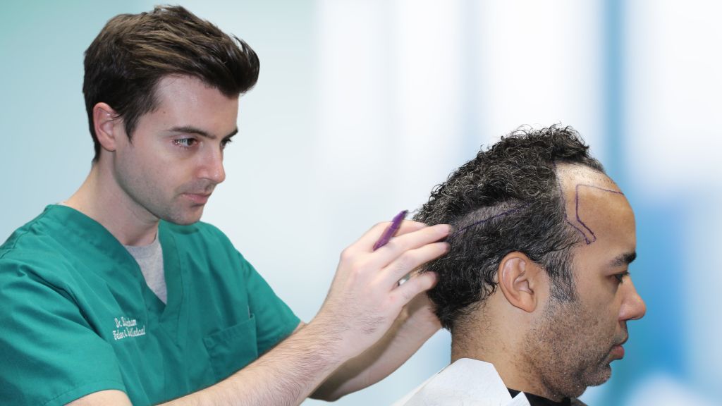 Feller & Bloxham Medical | Hair Transplant | St. Louis, MO