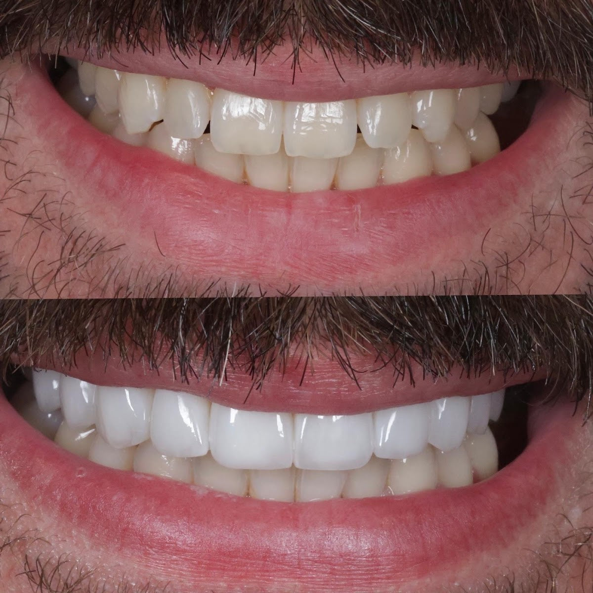 Cosmetic Smile Clinic - Birmingham Cosmetic Dentist — photo 5