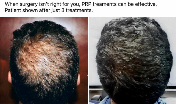 Tom Rosanelli, M.D | Hair Transplant | Honolulu, HI