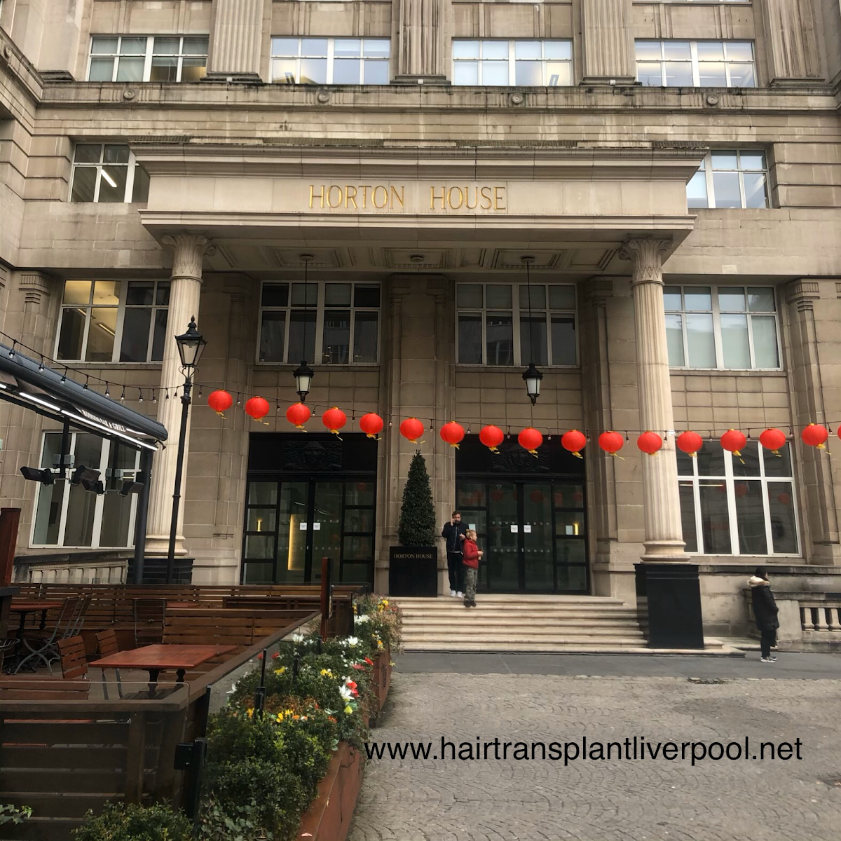 Hair Transplant Liverpool - Hair Transplant clinic in Liverpool, United Kingdom