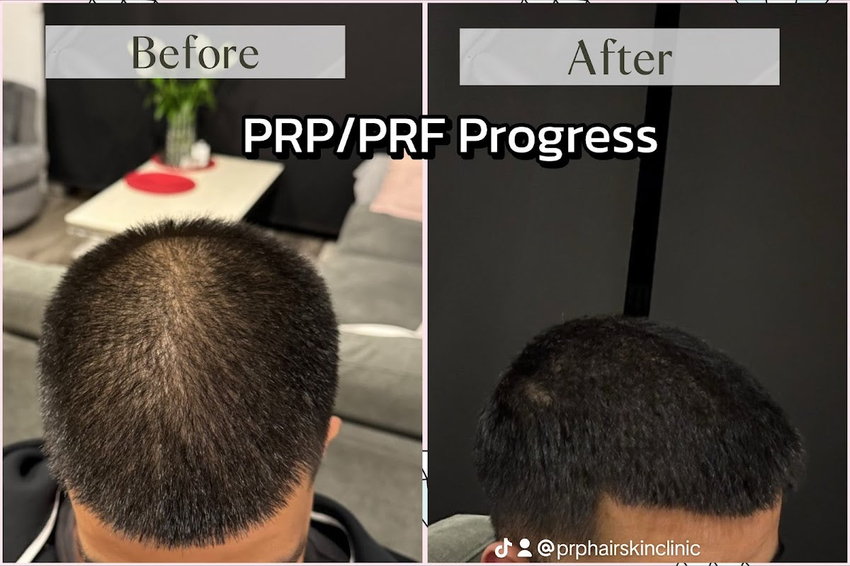 PRP Hair And Skin Clinic — photo 2