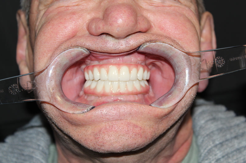 New Life Teeth - Dental Implants Clinic — photo 5