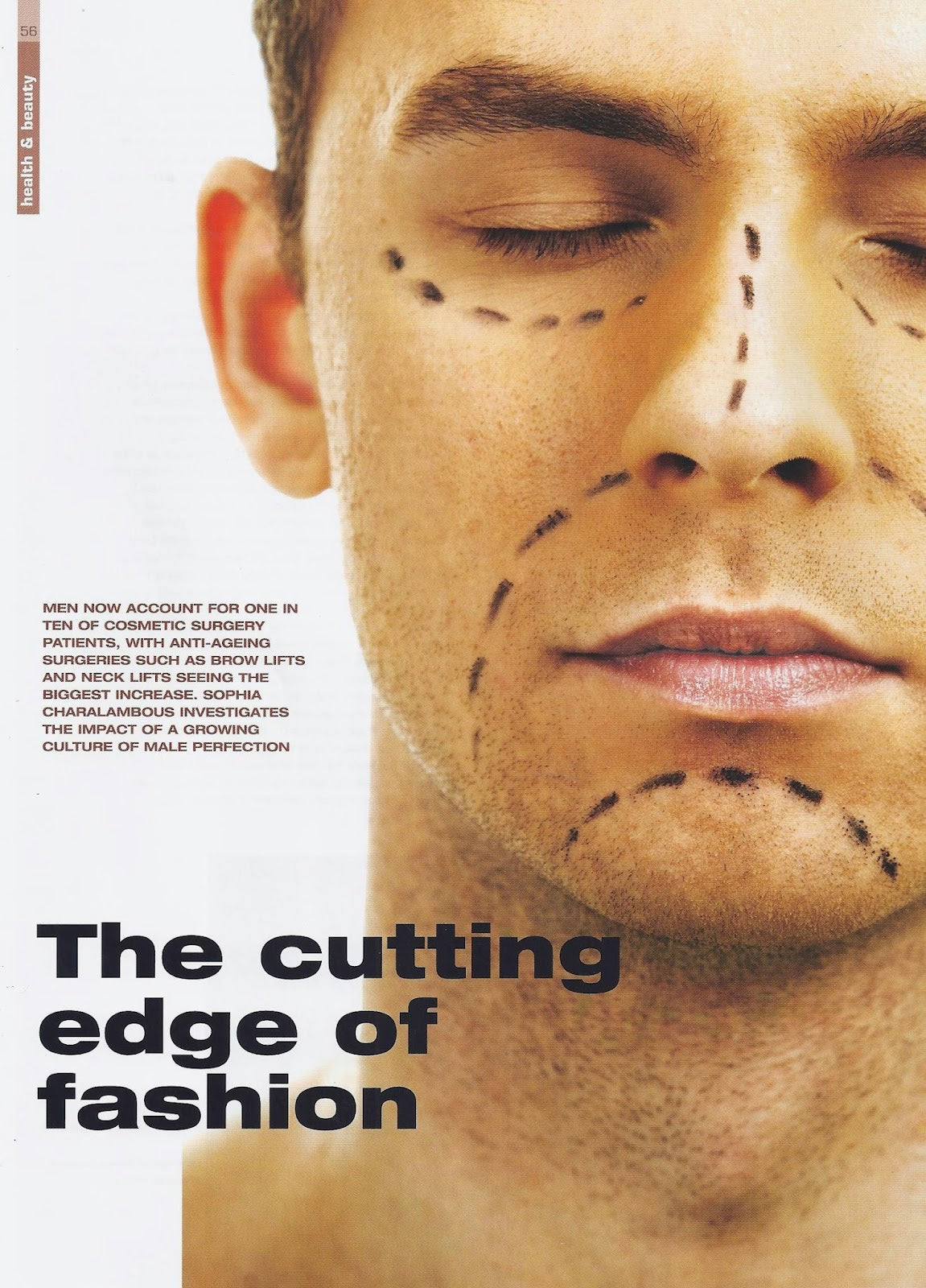 Plastic Surgeon London, UK: Dr. Maisam Fazel — photo 5