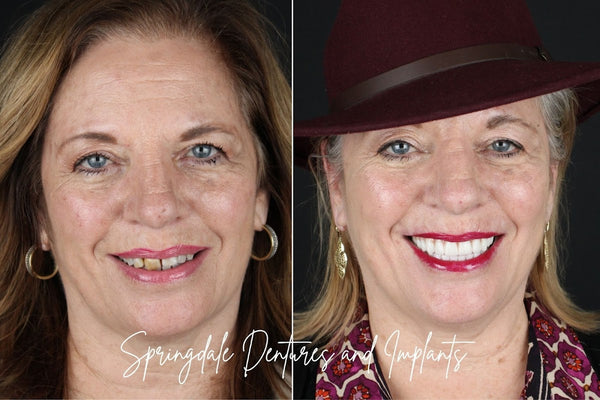 Dentures and Implants | Dental | Springdale, AR