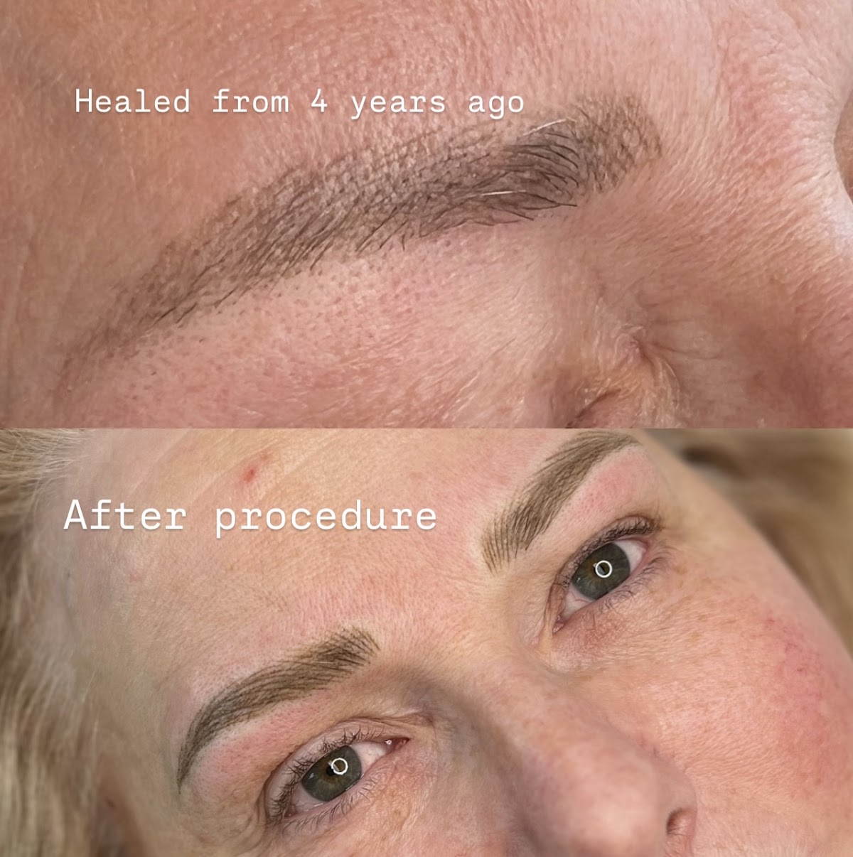 DejaVu Salon and Spa | Aesthetic Surgery | Biddeford, ME
