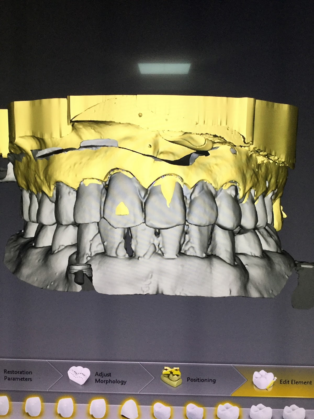 Dental Centre Turkey — Dr.Visor photo 5
