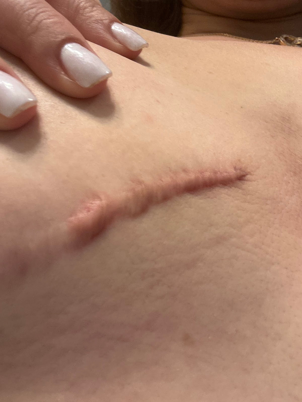 Capital Plastic Surgery | Aesthetic Surgery | Columbia, SC