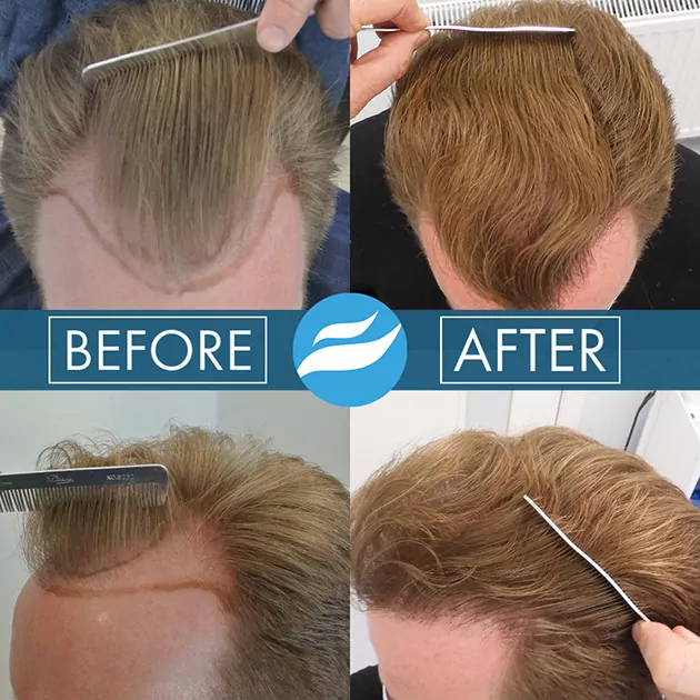 Dr. André Nel Hair Transplant Clinic — photo 5