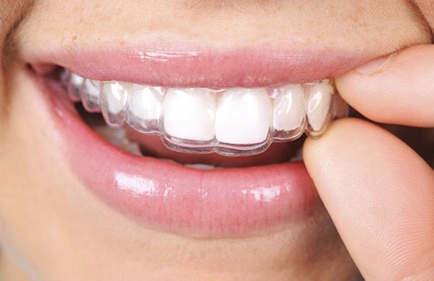 Highfield Dental Clinic Edgbaston - Dental clinic in Birmingham, United Kingdom