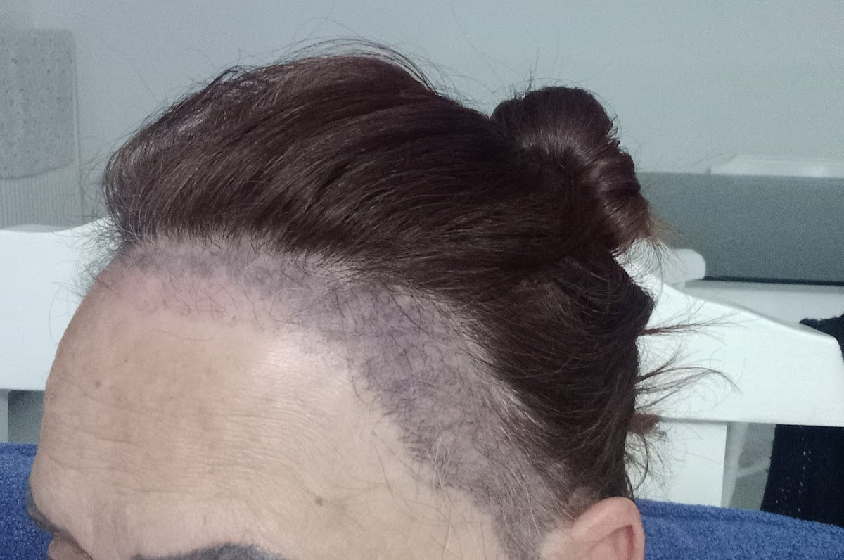 Dr. Muhammet ÖZGEHAN — Dr.Visor photo 5