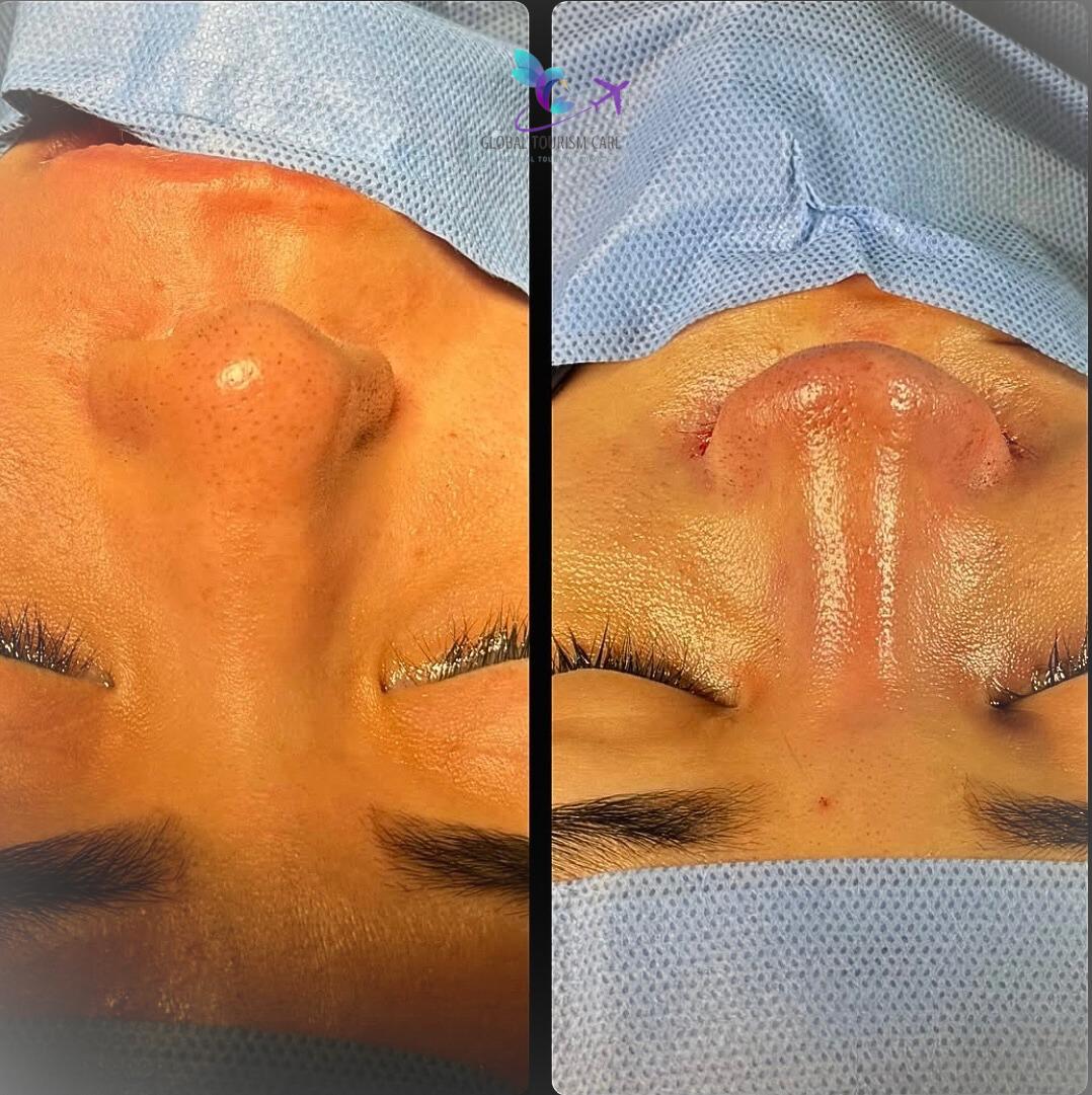 ALBGTC Med - Aesthetic Surgery clinic in Tiranë, Albania
