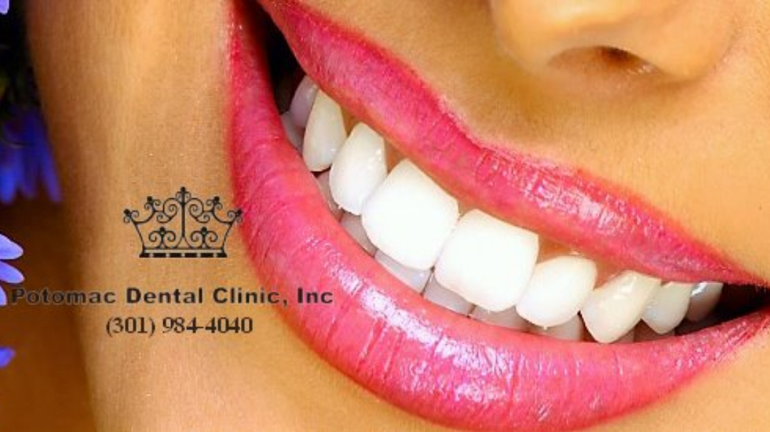 Potomac Dental Clinic | Dental | Rockville, MD