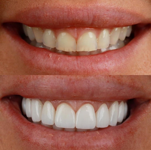 CDL - Dental Clinic Lisbon | Dental | 1900-228 Lisboa