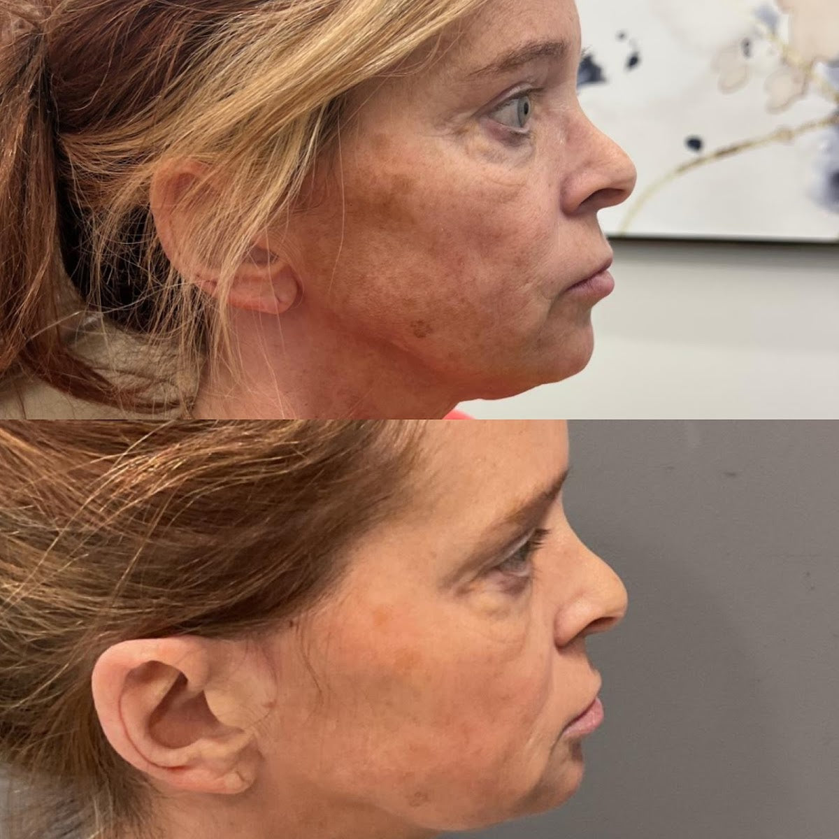 Healthylooks Med Spa & Wellness | Hair Transplant | Lee's Summit, MO