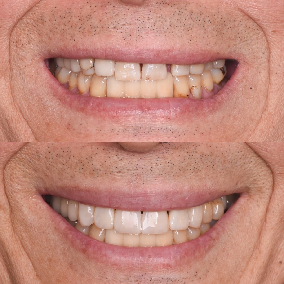 JP Dental | Dental | Hartford, CT