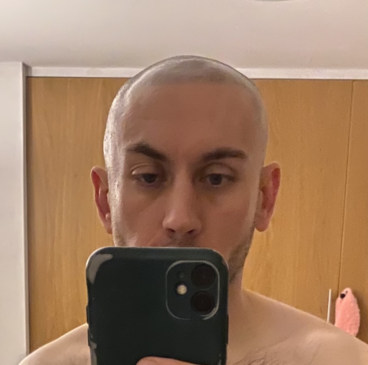 Skalp | Manchester Scalp Micropigmentation Clinic — Dr.Visor photo 3