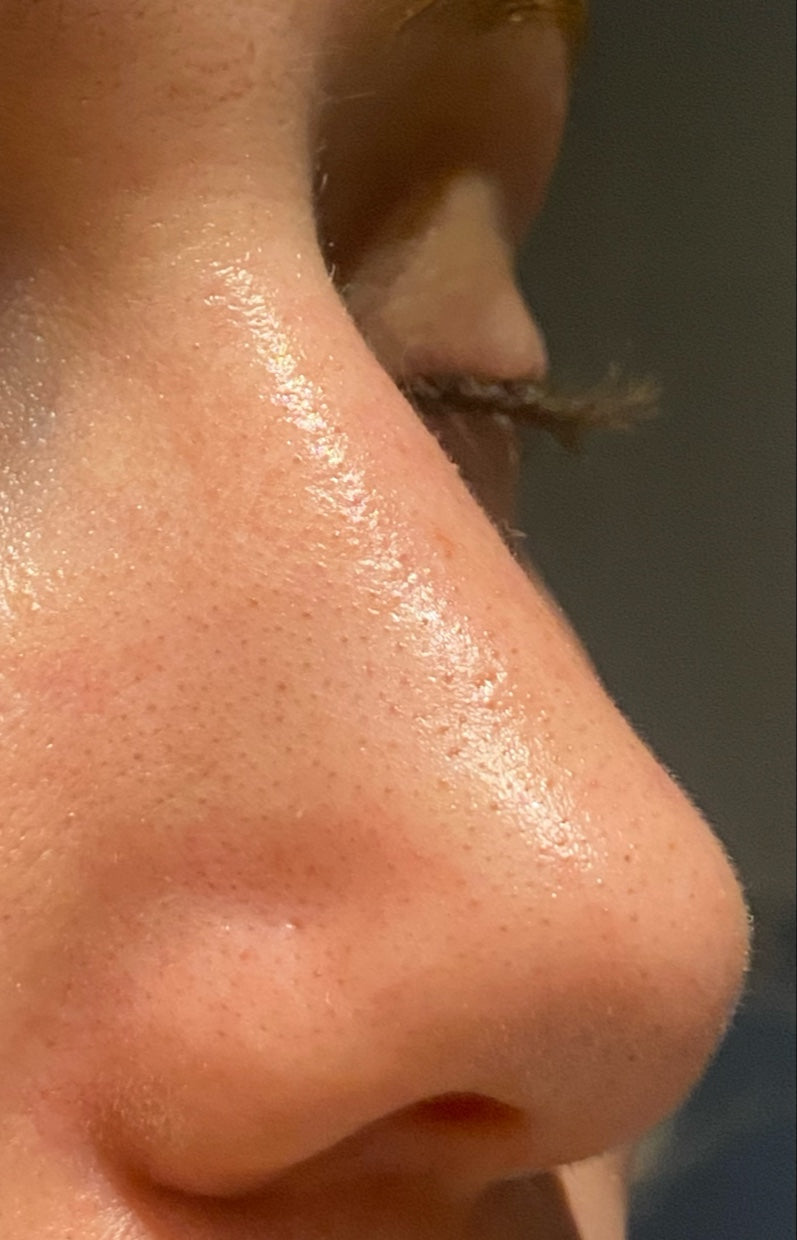 Op. Dr. Şükrü İşler Estetik ve Plastik Cerrahi - Bursa Estetik Kliniği — Dr.Visor photo 3