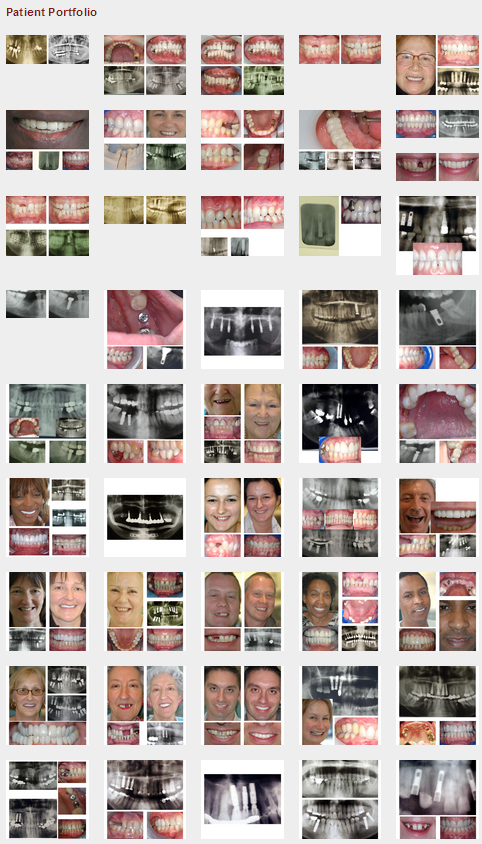 Life Dental Implants (by Dr Azhar Sheikh) — photo 2