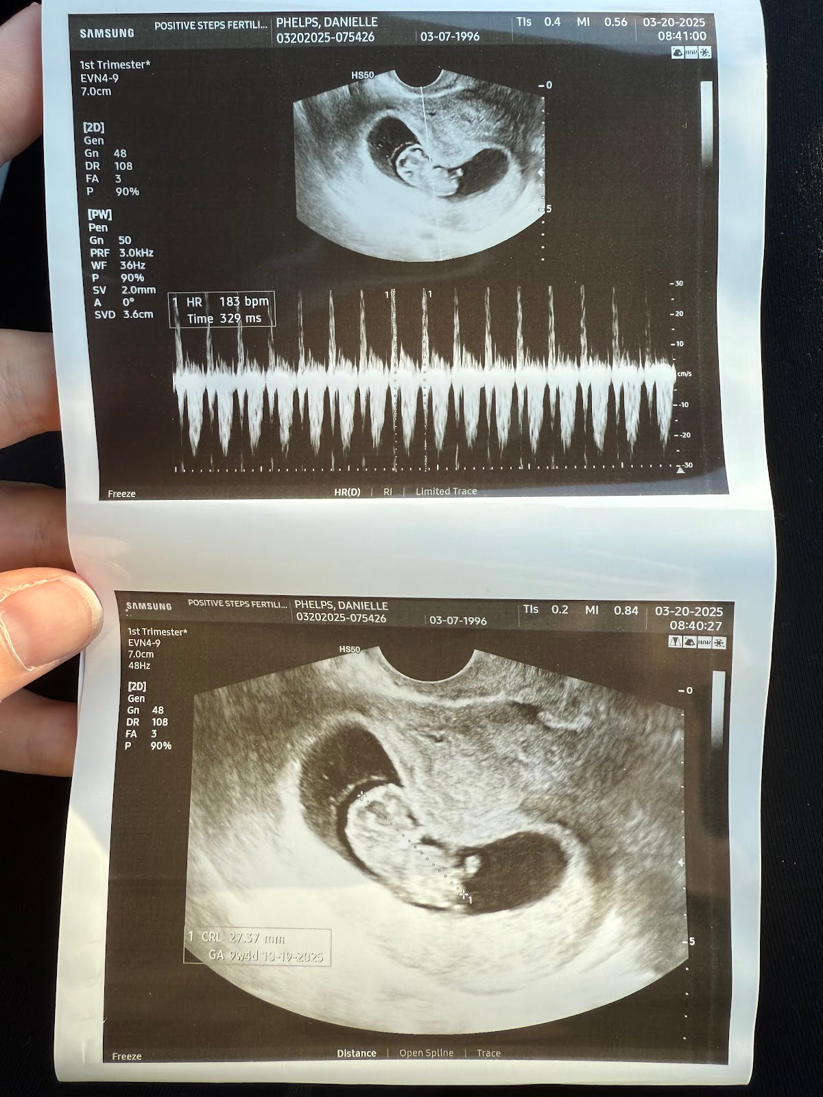 Positive Steps Fertility, 401 Cowan Rd, Suite A, , MS | IVF | Gulfport, MS
