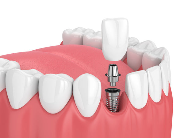 Dentistry & Braces | Dental | Las Vegas, NV