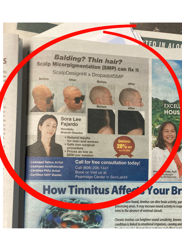 ScalpDesignHonolulu | Hair Transplant | 98-1005 Moanalua Rd Level 2, HI