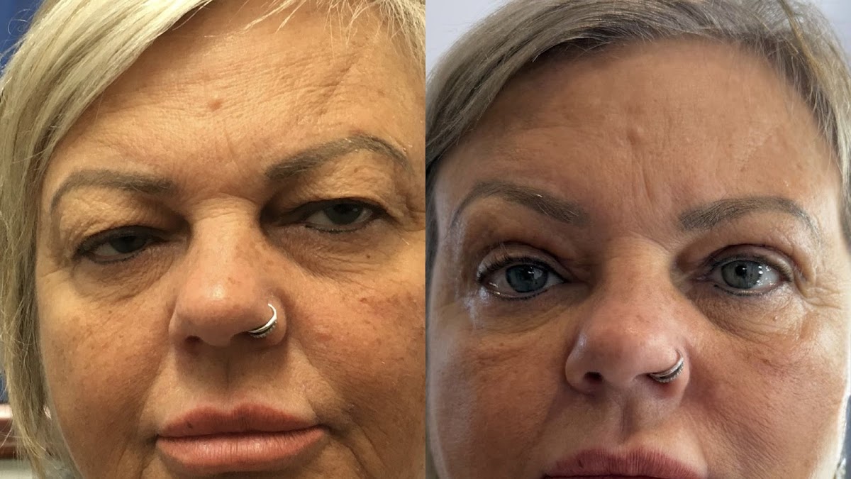 Mr. S. Jyothi – Aesthetic & Oculoplastic Surgeon — photo 4