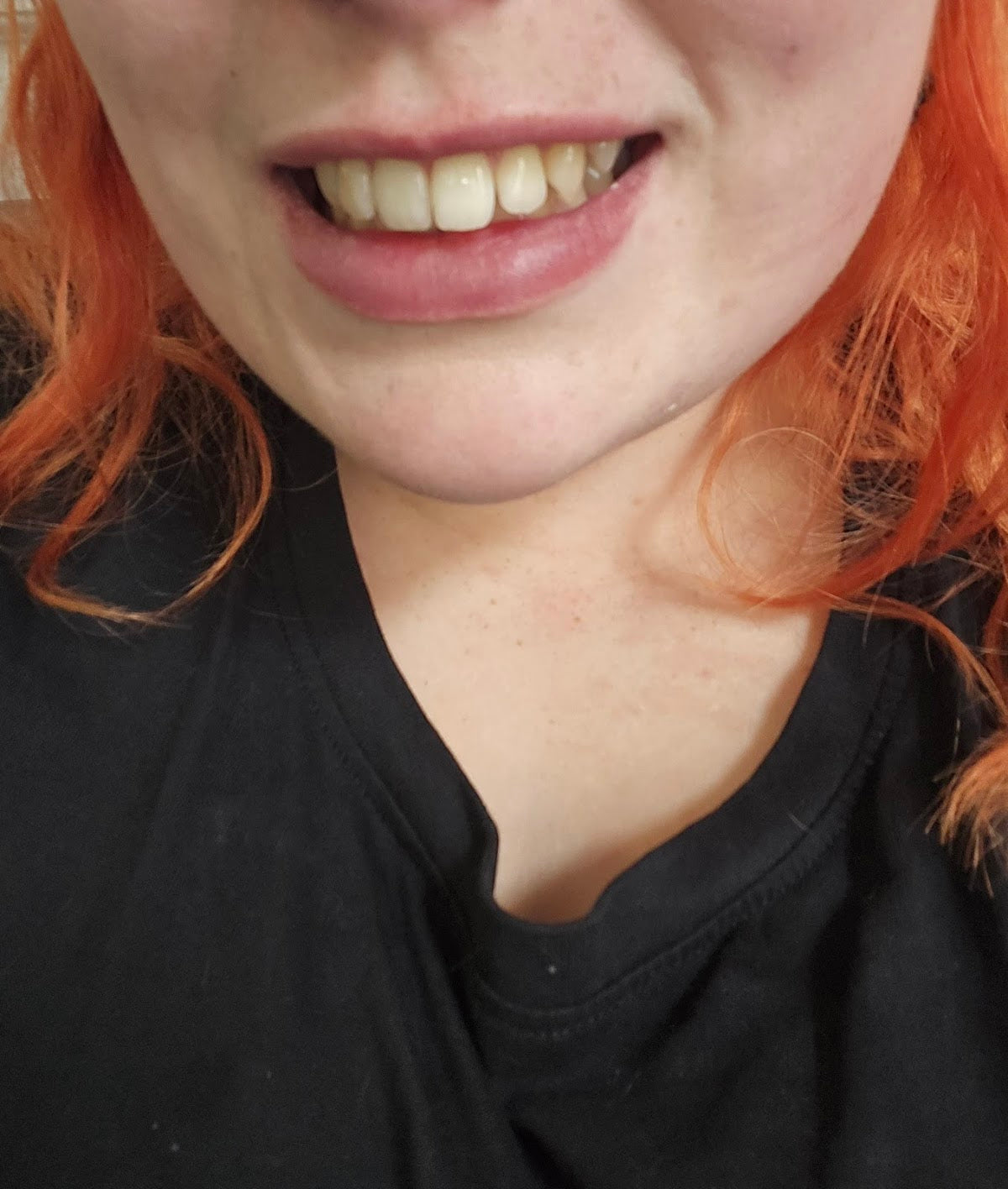 St Johns Dental Practice — Dr.Visor photo 2