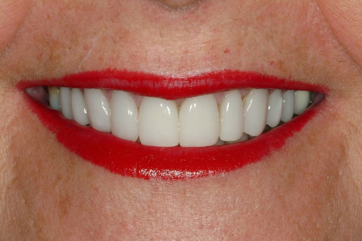 Meadowlark Dental Associates - , NE | Dental | Kearney, NE