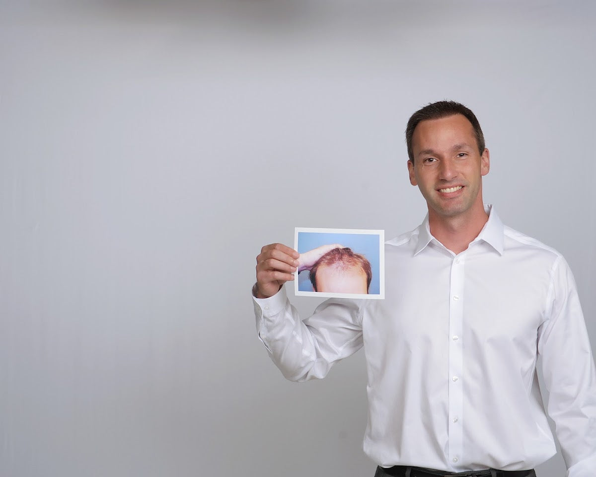 Hair Restoration | Hair Transplant | Kirkwood, MO