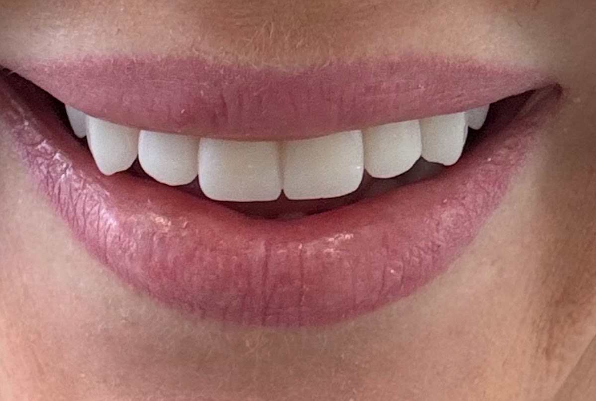 Alanya Dental Clinic - Alanya Dental - Dental Tourism Turkey — Dr.Visor photo 3