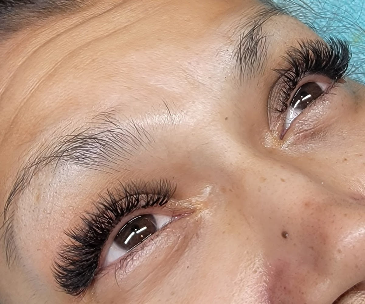 Dream Esthetics | Aesthetic Surgery | Great Falls, MT