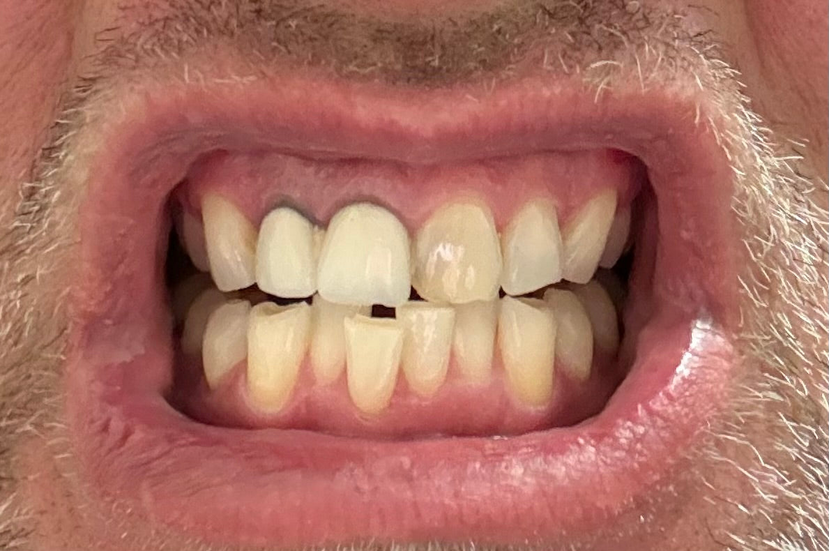 Vera Smile Dental Clinic — Dr.Visor photo 4