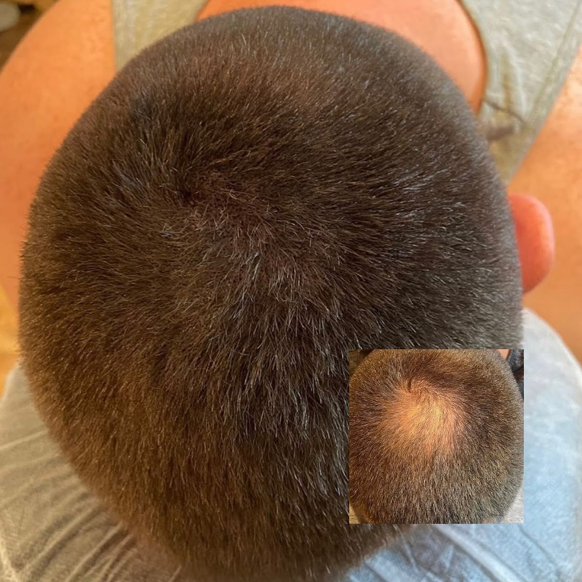 The Hairline Guy — photo 2