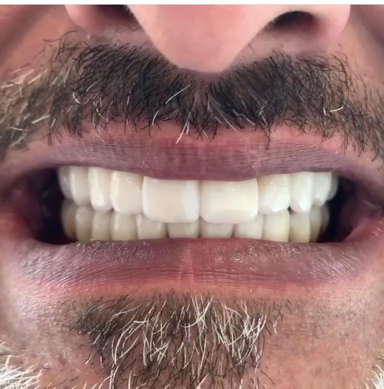 New Life Teeth — photo 3