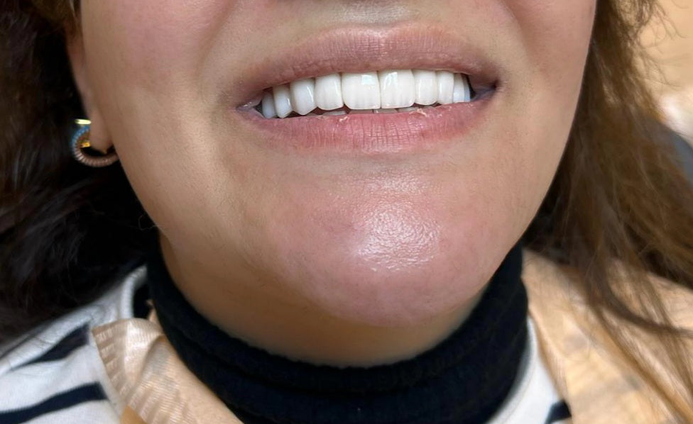 ELAY CLINIC…rhinoplasty,breast augmentation,bbl,liposuction,cosmetic surgery — Dr.Visor photo 5