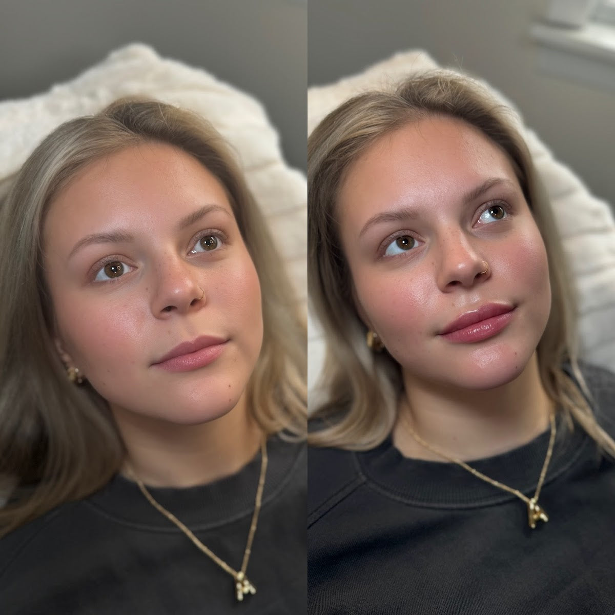 Natural Medical Aesthetics | Hair Transplant | Morgantown, WV