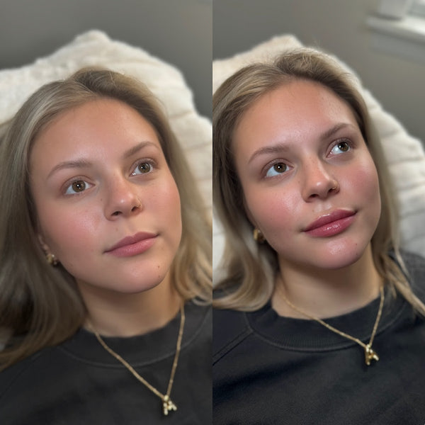 Natural Medical Aesthetics | Hair Transplant | Morgantown, WV