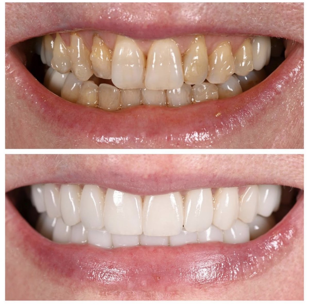 Dental Partners | Dental | Minot, ND