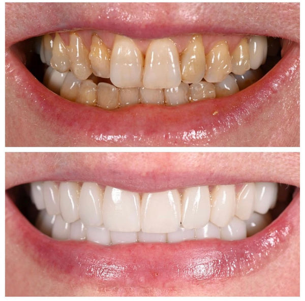 Dental Partners | Dental | Minot, ND