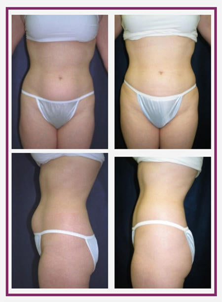 Plastic Surgery: George P. Chatson, M.D | Aesthetic Surgery | 8 Prospect St 2nd Floor, NH