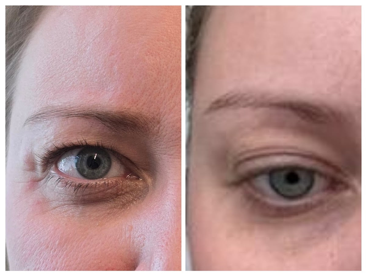 Achieve Aesthetics | Aesthetic Surgery | Lakewood, CO