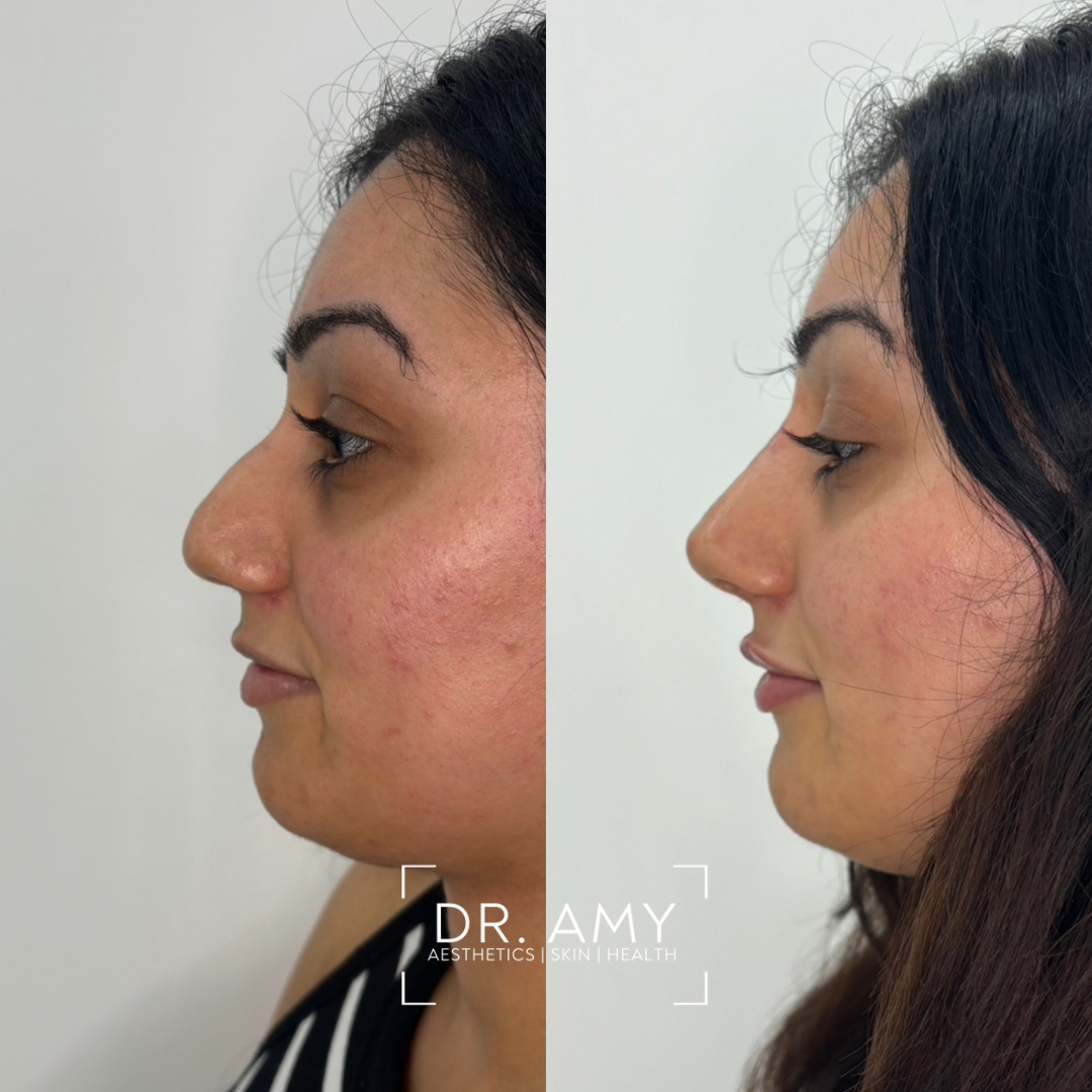 Dr Amy Aesthetics — photo 5