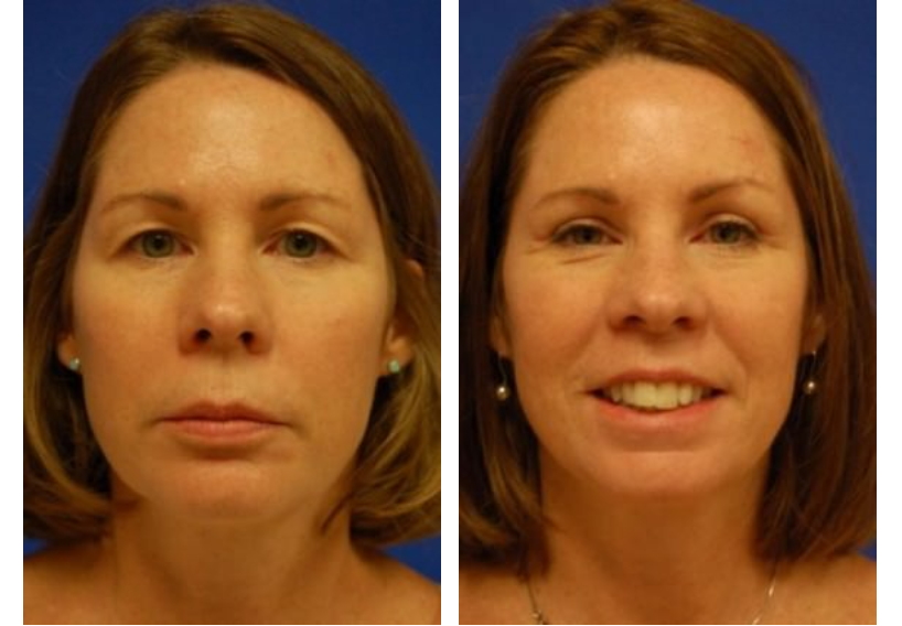 Randy Proffitt, MD | Aesthetic Surgery | Mobile, AL