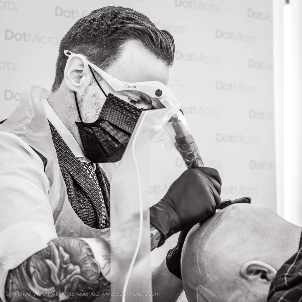 Dot Micro — Hair Transplant Clinic in Belfast