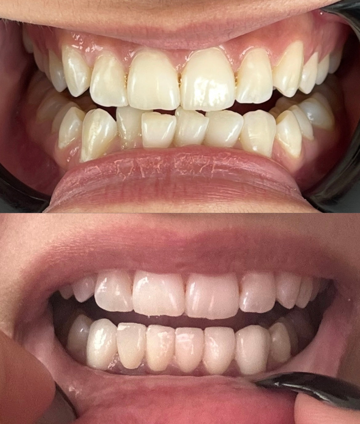 Özel DM Ağız ve Diş Sağlığı Polikliniği - İmplant - Ortodonti - Estetik Diş Hekimliği - Çocuk Diş Hekimi — Dr.Visor photo 4